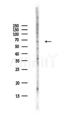 ST7 Antibody - Western blot analysis of lysates from Hela cells(UV,30min treatment), using ST7 Antibody at 1/1000 dilution.