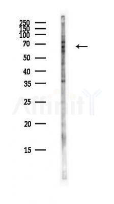 ST7 Antibody - Western blot analysis of lysates from COLO205 cells(heat-shock,45min treatment), using ST7 Antibody at 1/1000 dilution.