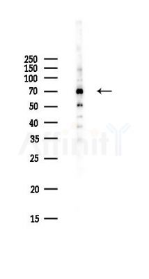 SCAI Antibody - Western blot analysis of lysates from Hela cells(UV,30min treatment), using SCAI Antibody at 1/1000 dilution.