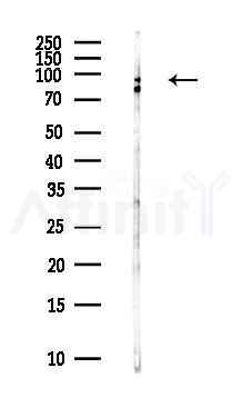 NSP3 Antibody - Western blot analysis of lysates from Hela cells(heat-shock,45min treatment), using NSP3 Antibody at 1/1000 dilution.