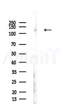 SMARCC1 Antibody - Western blot analysis of lysates from PC12 cells, using SMARCC1 Antibody at 1/1000 dilution.