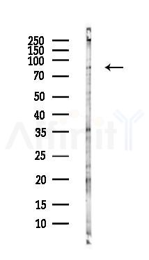 BORIS Antibody - Western blot analysis of lysates from Hela cells(heat-shock,45min treatment), using BORIS Antibody at 1/1000 dilution.