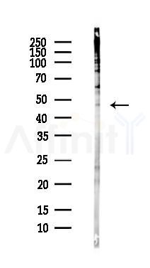 SNX7 Antibody - Western blot analysis of lysates from Hela cells(heat-shock,45min treatment), using SNX7 Antibody at 1/1000 dilution.