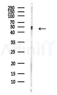TMPRSS11D Antibody - Western blot analysis of lysates from Hela cells(heat-shock,45min treatment), using TMPRSS11D Antibody at 1/1000 dilution.