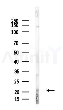 NCE2 Antibody - Western blot analysis of lysates from PC12 cells, using NCE2 Antibody at 1/1000 dilution.