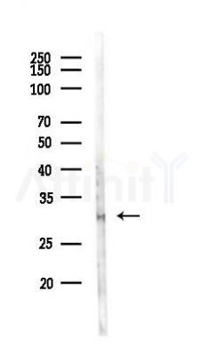 Pirh2 Antibody - Western blot analysis of lysates from A375 cells(heat-shock,45min treatment), using Pirh2 Antibody at 1/1000 dilution.