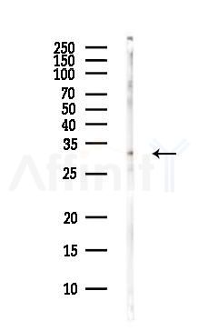TXNL1 Antibody - Western blot analysis of lysates from Hela cells(heat-shock,45min treatment), using TXNL1 Antibody at 1/1000 dilution.