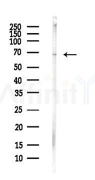 GLTSCR2 Antibody - Western blot analysis of lysates from Hela cells(heat-shock,45min treatment), using GLTSCR2 Antibody at 1/1000 dilution.