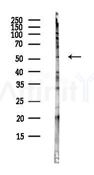 TID1 Antibody - Western blot analysis of lysates from Hela cells(heat-shock,45min treatment), using TID1 Antibody at 1/1000 dilution.