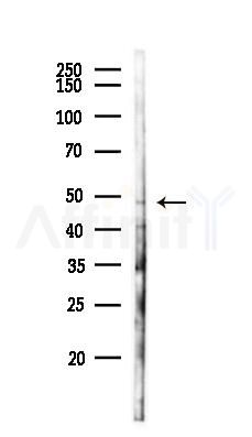 CMPK2 Antibody - Western blot analysis of lysates from HepG2 cells(heat-shock,45min treatment), using CMPK2 Antibody at 1/1000 dilution.