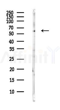 DARS Antibody - Western blot analysis of lysates from Hela cells(heat-shock,45min treatment), using DARS Antibody at 1/1000 dilution.