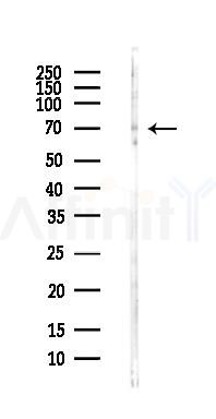 Dystrobrevin beta Antibody - Western blot analysis of lysates from Hela cells(heat-shock,45min treatment), using Dystrobrevin beta Antibody at 1/1000 dilution.