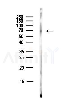 AFM Antibody - Western blot analysis of lysates from COLO205 cells(heat-shock,45min treatment), using AFM Antibody at 1/1000 dilution.