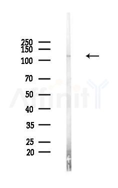 FAM83B Antibody - Western blot analysis of lysates from PC12 cells, using FAM83B Antibody at 1/1000 dilution.