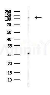FAM83B Antibody - Western blot analysis of lysates from Hela cells(heat-shock,45min treatment), using FAM83B Antibody at 1/1000 dilution.