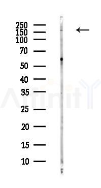 hUPF2/RENT2 Antibody - Western blot analysis of lysates from Hela cells(heat-shock,45min treatment), using hUPF2/RENT2 Antibody at 1/1000 dilution.