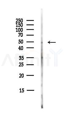 PRMT2 Antibody - Western blot analysis of lysates from EC304 cells(LPS,4h treatment), using PRMT2 Antibody at 1/1000 dilution.