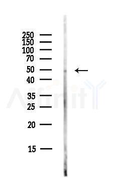PRMT2 Antibody - Western blot analysis of lysates from COLO205 cells(heat-shock,45min treatment), using PRMT2 Antibody at 1/1000 dilution.