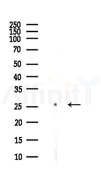 DCXR Antibody - Western blot analysis of lysates from Hela cells(heat-shock,45min treatment), using DCXR Antibody at 1/1000 dilution.