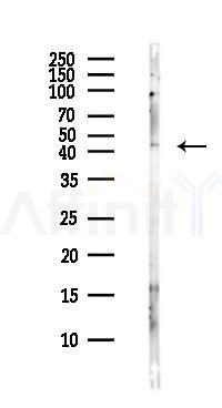 ChT1 Antibody - Western blot analysis of lysates from Hela cells(heat-shock,45min treatment), using ChT1 Antibody at 1/1000 dilution.
