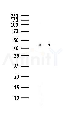 ALS2CR1 Antibody - Western blot analysis of lysates from Hela cells(heat-shock,45min treatment), using ALS2CR1 Antibody at 1/1000 dilution.