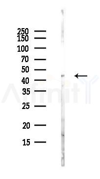 ALS2CR1 Antibody - Western blot analysis of lysates from MC-3T3-E1 cells(heat-shock,45min treatment), using ALS2CR1 Antibody at 1/1000 dilution.