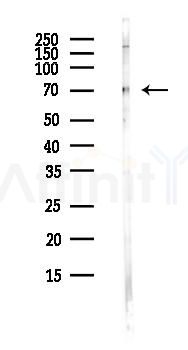 PAPSS1 Antibody - Western blot analysis of lysates from Hela cells(heat-shock,45min treatment), using PAPSS1 Antibody at 1/1000 dilution.