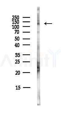 Estrogen-induced gene 121 protein Antibody - Western blot analysis of lysates from COLO205 cells(heat-shock,45min treatment), using Estrogen-induced gene 121 protein Antibody at 1/1000 dilution.