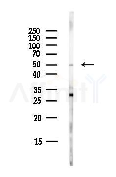 WASH1 Antibody - Western blot analysis of lysates from EC304 cells(LPS,4h treatment), using WASH1 Antibody at 1/1000 dilution.