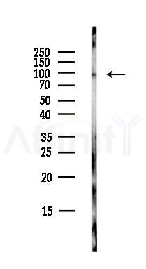 ATP6V0A1 Antibody - Western blot analysis of lysates from COLO205 cells(heat-shock,45min treatment), using ATP6V0A1 Antibody at 1/1000 dilution.