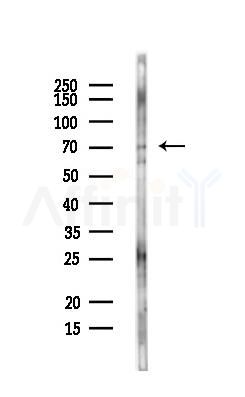 KATNAL2 Antibody - Western blot analysis of lysates from MCF7 cells(heat-shock,45min treatment), using KATNAL2 Antibody at 1/1000 dilution.