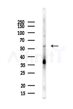 UBXN7 Antibody - Western blot analysis of lysates from MCF7 cells(heat-shock,45min treatment), using UBXN7 Antibody at 1/1000 dilution.
