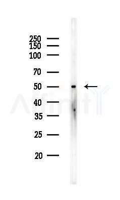 TRAM1 Antibody - Western blot analysis of lysates from HUVEC cells, using TRAM1 Antibody at 1/1000 dilution.