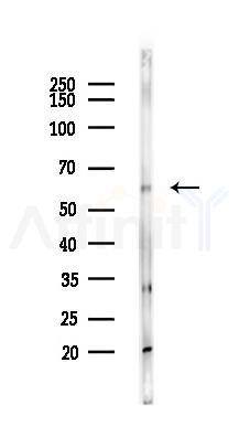 PGM3 Antibody - Western blot analysis of lysates from PC12 cells, using PGM3 Antibody at 1/1000 dilution.