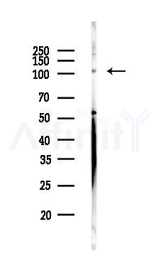 SMCR8 Antibody - Western blot analysis of lysates from HUVEC cells, using SMCR8 Antibody at 1/1000 dilution.