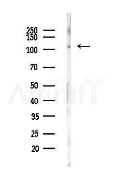 SMCR8 Antibody - Western blot analysis of lysates from PC12 cells, using SMCR8 Antibody at 1/1000 dilution.