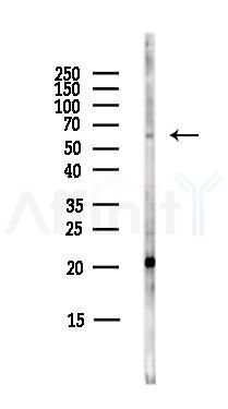 SLAMF7 Antibody - Western blot analysis of lysates from COLO205 cells(heat-shock,45min treatment), using SLAMF7 Antibody at 1/1000 dilution.