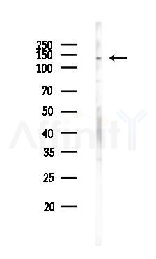 TIP120A Antibody - Western blot analysis of lysates from HUVEC cells, using TIP120A Antibody at 1/1000 dilution.