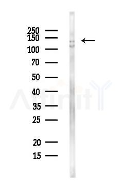 TIP120A Antibody - Western blot analysis of lysates from MCF7 cells(heat-shock,45min treatment), using TIP120A Antibody at 1/1000 dilution.