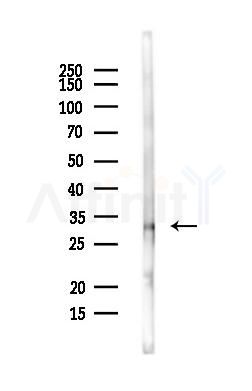 PCGF3 Antibody - Western blot analysis of lysates from MCF7 cells(heat-shock,45min treatment), using PCGF3 Antibody at 1/1000 dilution.