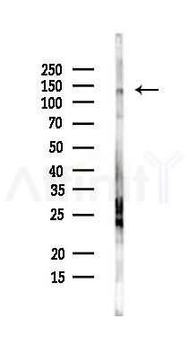 DSPP Antibody - Western blot analysis of lysates from Mouse liver, using DSPP Antibody at 1/1000 dilution.