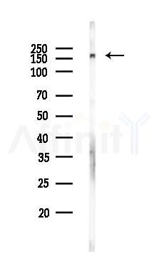 IBP160 Antibody - Western blot analysis of lysates from HUVEC cells, using IBP160 Antibody at 1/1000 dilution.