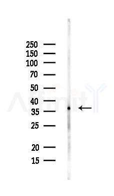 N myc interactor Antibody - Western blot analysis of lysates from Mouse liver, using N myc interactor Antibody at 1/1000 dilution.