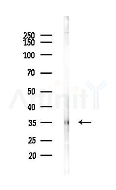 N myc interactor Antibody - Western blot analysis of lysates from PC12 cells, using N myc interactor Antibody at 1/1000 dilution.
