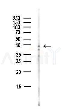 WDR77 Antibody - Western blot analysis of lysates from EC304 cells(LPS,4h treatment), using WDR77 Antibody at 1/1000 dilution.