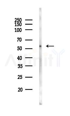 PPP2R5B Antibody - Western blot analysis of lysates from HUVEC cells, using PPP2R5B Antibody at 1/1000 dilution.