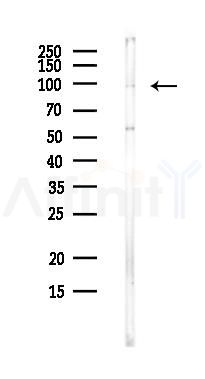 DDX23 Antibody - Western blot analysis of lysates from PC12 cells(heat-shock,45min treatment), using DDX23 Antibody at 1/1000 dilution.