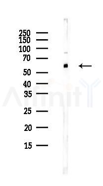RNF87 Antibody - Western blot analysis of lysates from Hela cells(UV,30min treatment), using RNF87 Antibody at 1/1000 dilution.