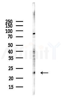 Proteasome 20S beta 3 Antibody - Western blot analysis of lysates from Hela cells(UV,30min treatment), using Proteasome 20S beta 3 Antibody at 1/1000 dilution.