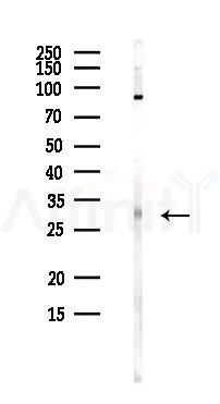 Uroplakin III Antibody - Western blot analysis of lysates from PC12 cells(heat-shock,45min treatment), using Uroplakin III Antibody at 1/1000 dilution.